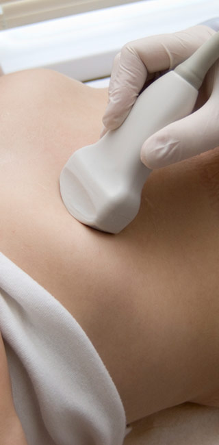 Ultrasound Ultrasound