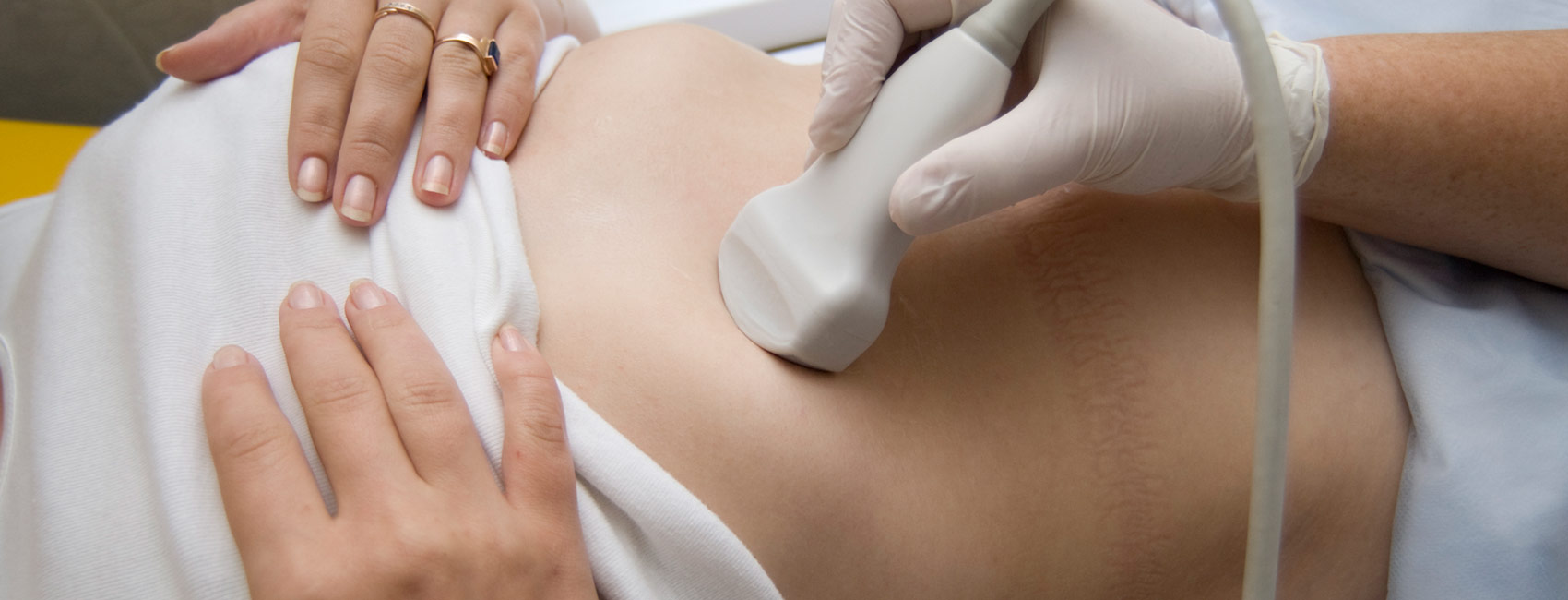 Ultrasound Ultrasound